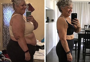Chloe T. before and after